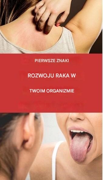19 ostrzegawczych znaków, że rak rozwija się w twoim ciele
